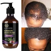 Rosemary Onion Strengthening Shampoo